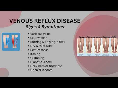 Amputation Prevention Center