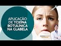 Aplicação de Toxina Botulínica na Glabela