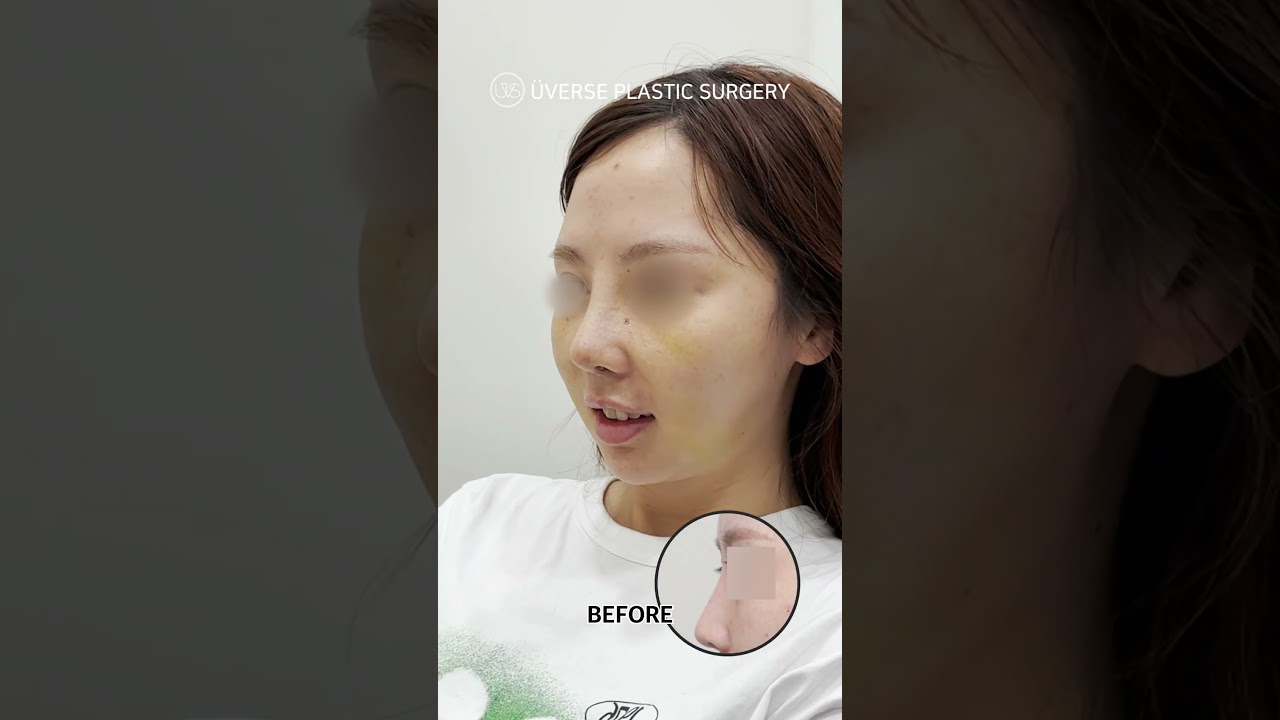 [Вэвэрс Гоо Сайхны Мэс Заслын Эмнэлэг] Д+7 Гоёмсог хамар, Вэвэрс👃