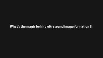 Formation of the ultrasound image and other principles