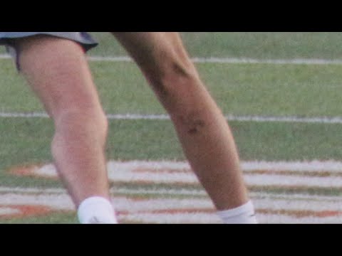 Lake Catholic reports findings of investigation, after lacrosse player wears swastika on leg