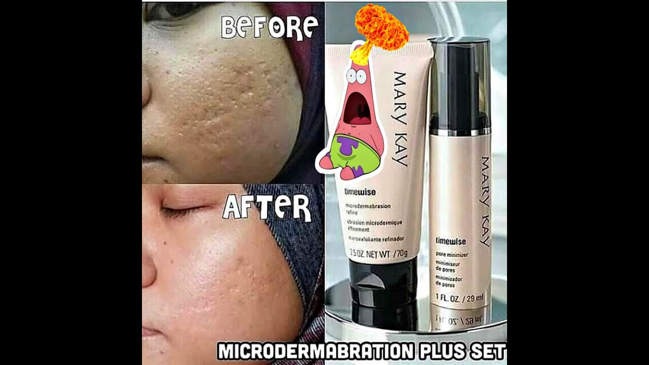 Microdermabrasion Tutorial YouTube