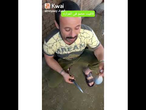 لاقيت حصو داخل المراره بتاع العجل