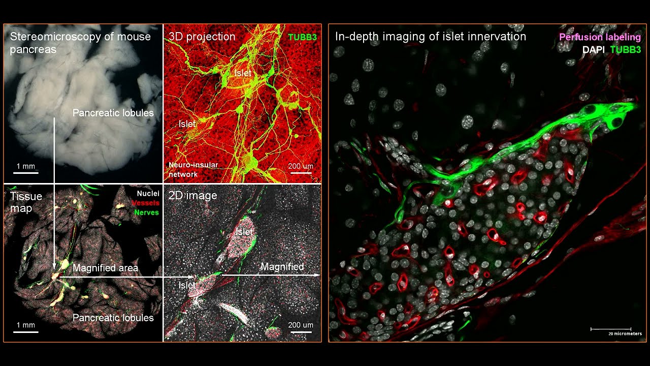 High-definition imaging of mouse pancreatic islet, from peri- to intra-islet domain (1080p HD)