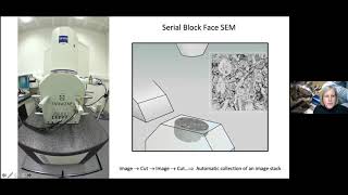 Lucy Collinson - Finding the needle in the haystack with 3D CLEM - Imaging ONEWORLD