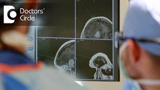 What are treatments for Brain Tumour? - Dr. Bopanna K M