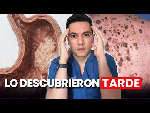Pensaron que era gastritis durante meses, hasta que descubrieron un cáncer de estómago