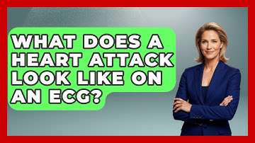 What Does A Heart Attack Look Like On An ECG? - Cardiology Community