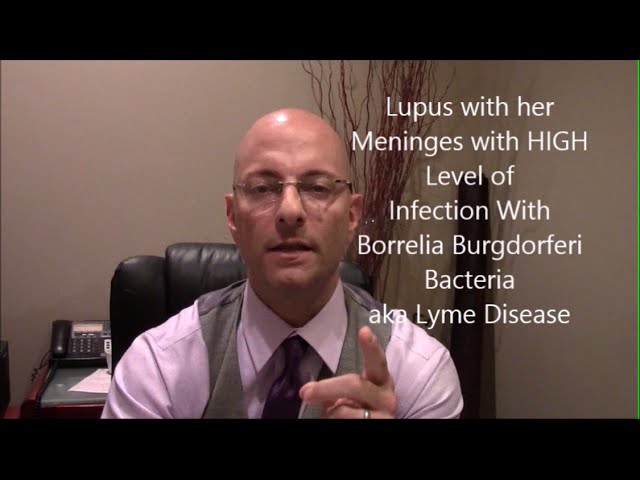 What Causes Lupus Symptoms And Lupus Antibodies?