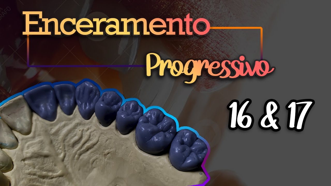 Anatomia e Escultura Dental Enceramento Diagnóstico Progressivo Primeiro e Segundo Molar Anatomia e Escultura Dental Enceramento Diagnóstico Progressivo Primeiro e Segundo Molar