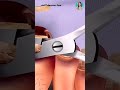 ASMR FootCare Extraction Treatment Animation #asmr #reels #viralreels #footcare #shorts