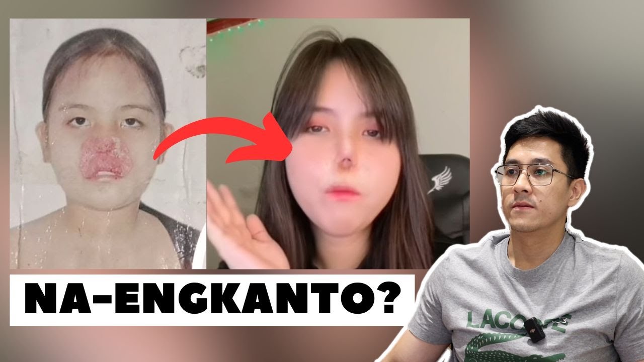 BABAE, NASIRA ANG ILONG DAHIL SA MISTERYOSONG SAKIT