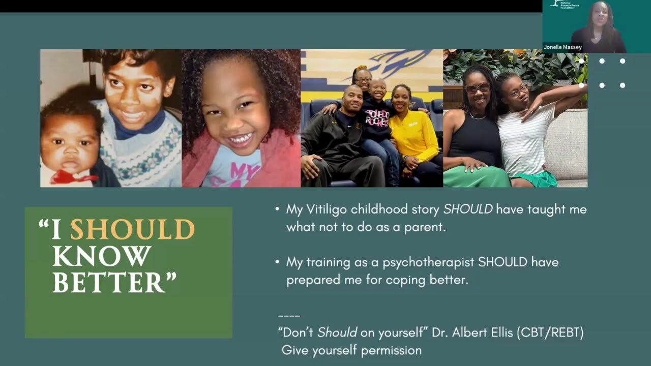 Parenting a child with alopecia Supporting your child without transferring the weight