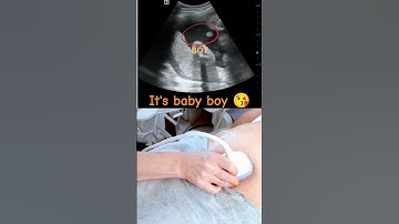 Ultrasound showing boy baby !!!🤰