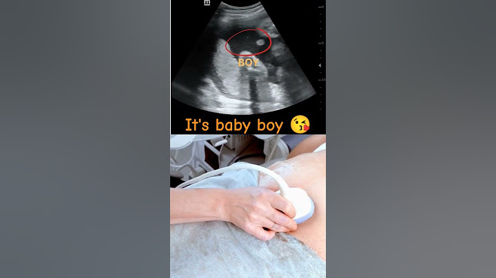 Ultrasound showing boy baby !!!🤰