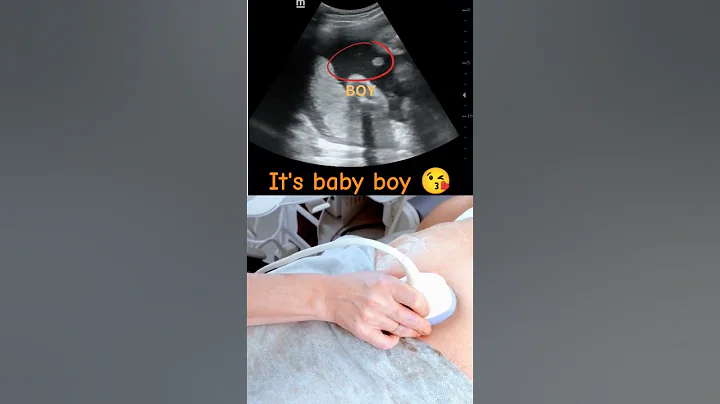 Ultrasound showing boy baby !!!🤰 - DayDayNews