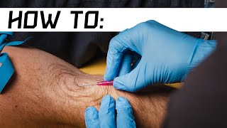 How to Start an IV  Live Demo