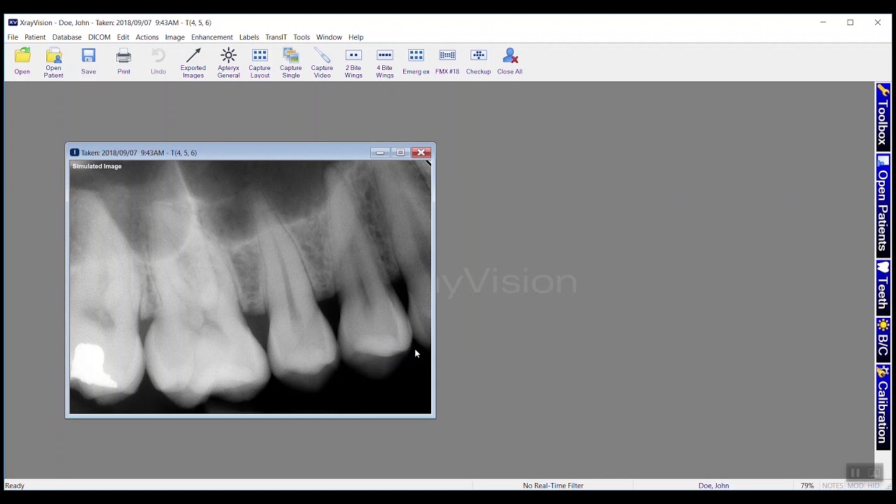 Xrayvision Training: Apteryx XrayVision 4: Emailing Images - YouTube