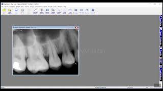 Training: Apteryx XrayVision 4: Emailing Images