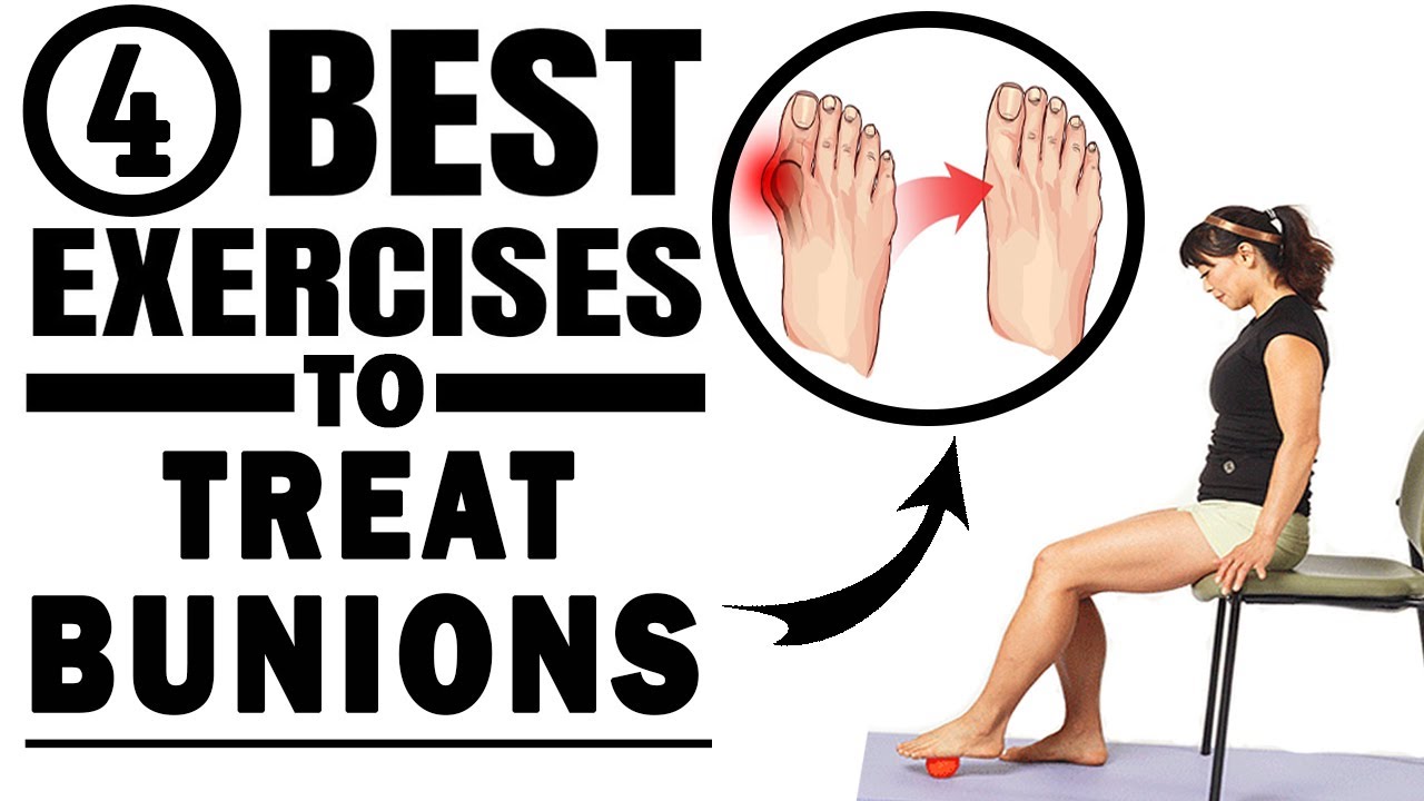 4 Exercises to Fix Bunions Naturally How to Treat Bunions with