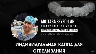 Индивидуальная каппа для домашнего отбеливания