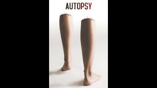 Autopsy