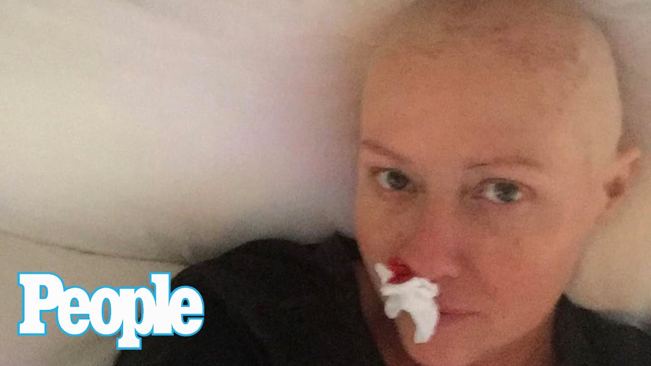 Shannen Doherty shares 'truthful' photos of her cancer journey