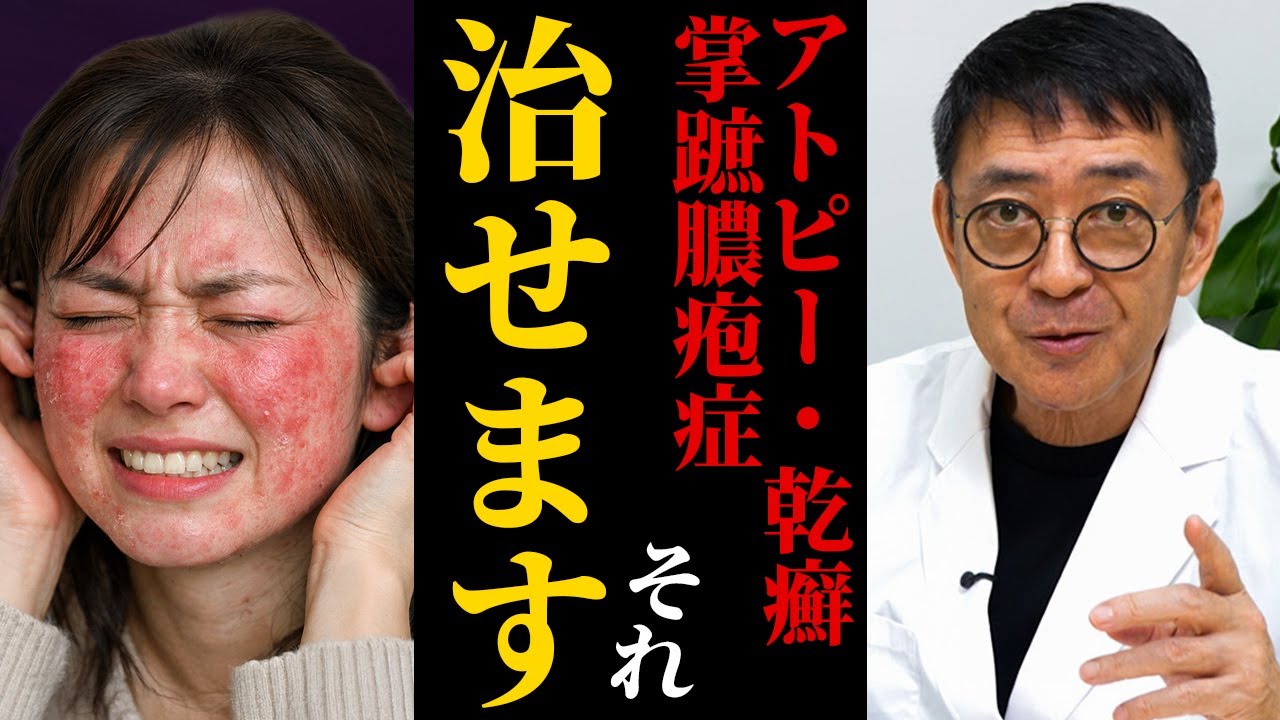 【皮膚科の革命】アトピー・乾癬・掌蹠膿疱症に新常識！「塗る温泉」と呼ばれる最新クリームとは？