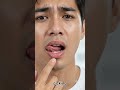 How to Care for Dry Lips Naturally 👄 | Health Tips#healthtips #youtubeshorts #viral #health #shorts