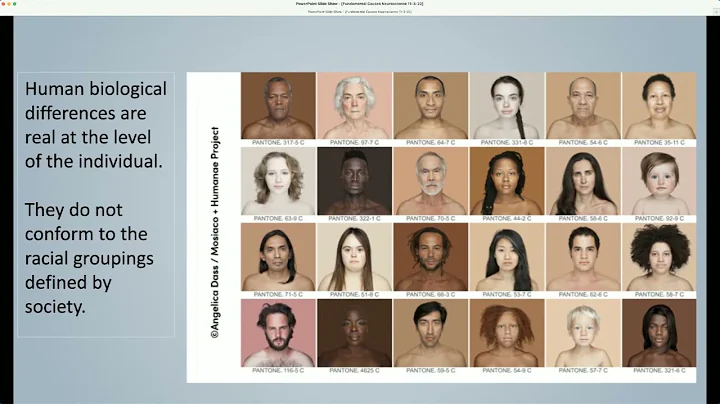 Fundamental Cause Theory: How Racism Operates As a...