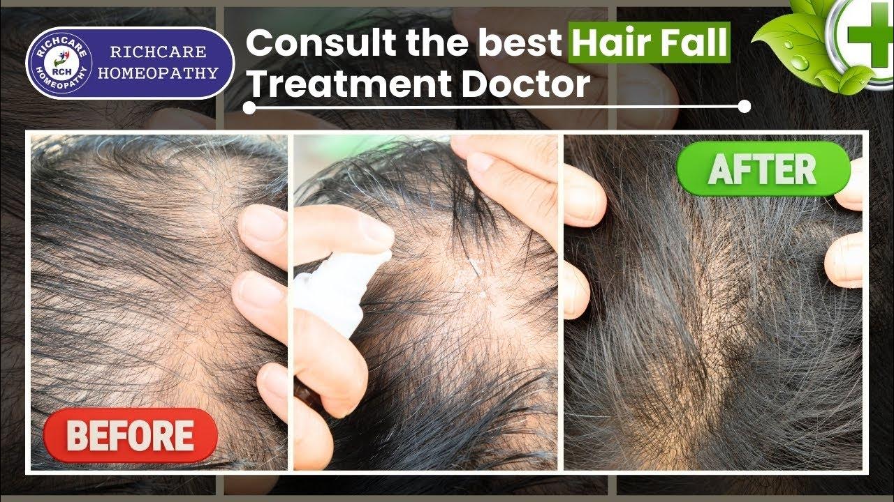 Know Rout Cause Of Hair Fall Problem Hair fall Treatment By Dr Nivedita Ric Care Homeopath