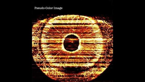 Iris and Limbus OCT Angiography using TOPCON Triton