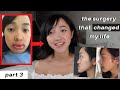 DOUBLE JAW SURGERY changed my life | Before & After | i hated myself (PART 3)