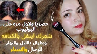 حصريا لاول مره على اليوتيوب تطويل الشعر القصير وعلاج الصلع بصفة نهائيه خاصةمقدمةالرأس والحدمن تساقط