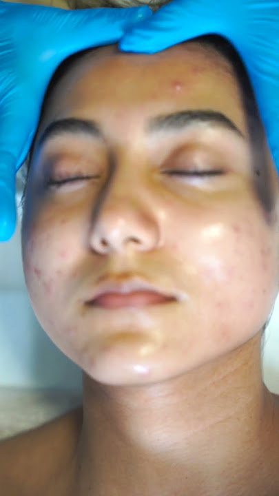 Unveil Radiant Skin with Bellanova