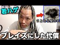 【髪の毛】若ハゲが編み込みブレイズを切った結果が衝撃過ぎた