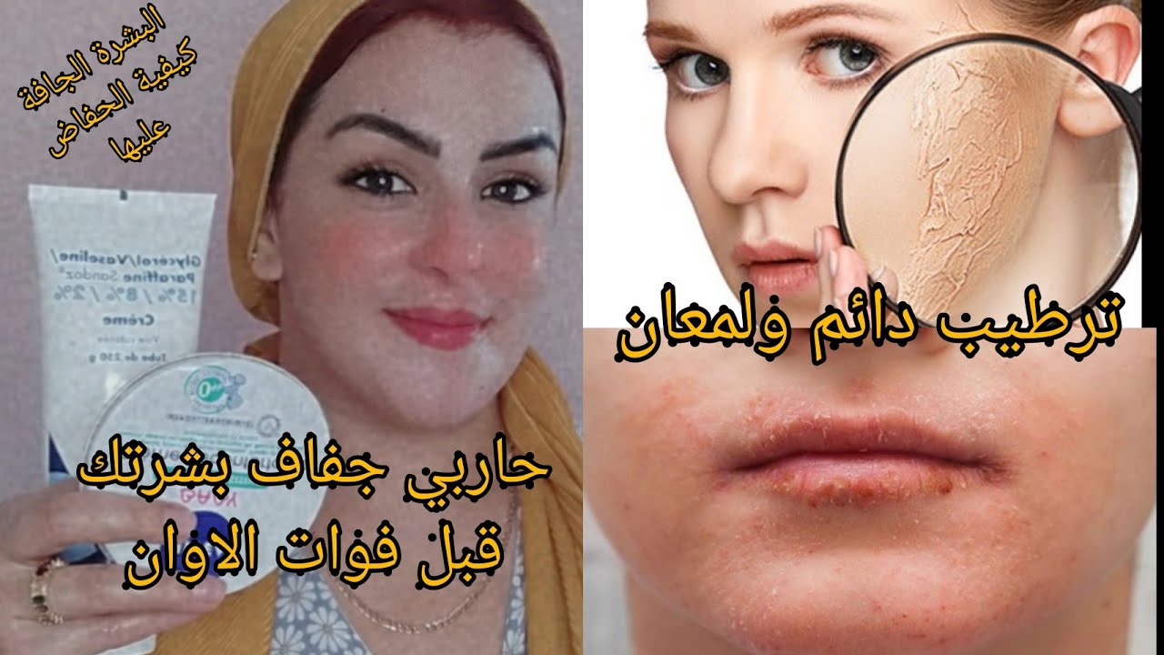 أجي نوريك العناية بالبشرة الجافة فهاد الخريف،بعش تولي مهنية من مشاكلها