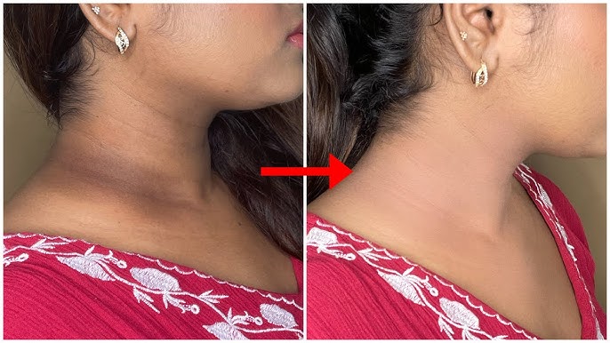THE BEST TRICK TO HIDE YOUR DARK NECK