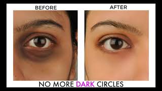 Remove dark circles under eyes reddit//