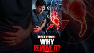 😨What is appendix and why operation are important || #facts #shorts #operation