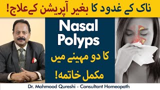 Nasal Polyps Ka Atma | Homeopathic Treatment of Nasal Polyps screenshot 4