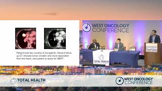 Lung Cancer Panel Discussion - Ramakrishna Battini, MD (Moderator)