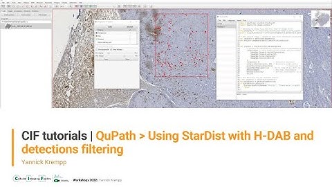 CIF Tutorials | QuPath : Using StarDist with H-DAB images and detections filtering