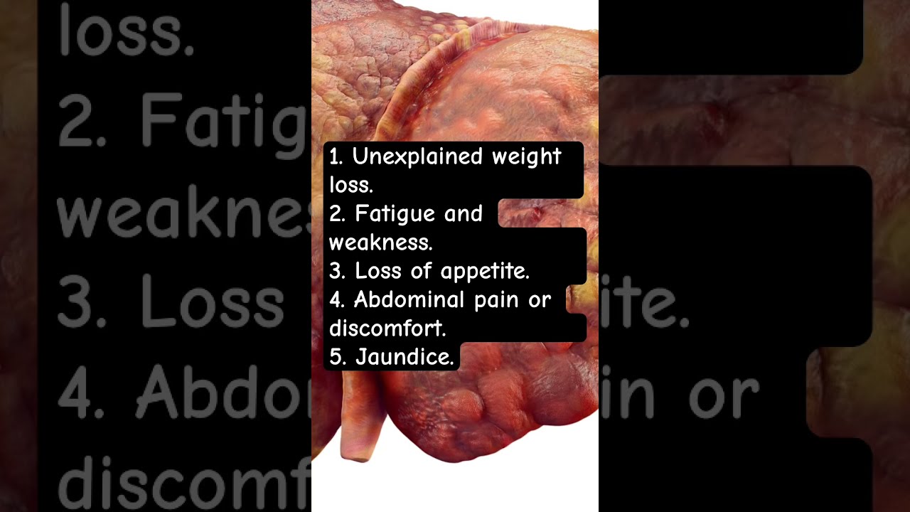 5 Silent Signs That May Indicate Liver Cancer 