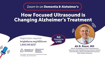 How Focused Ultrasound is Changing Alzheimer