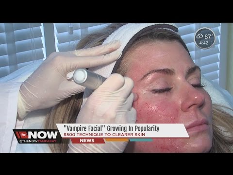 The vampire facial is the hot new trend in staying youthful. #TheNowTampaBay