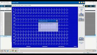 Connex Cardio ECG and eClinicalWorks Web Application Demo - US English screenshot 4