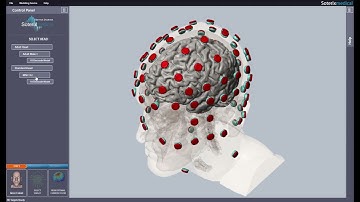 Soterix Medical HD-Targets Version 4.0