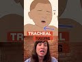 URGENT: Recognize RSV Warning Signs for Babies | AAP #shorts