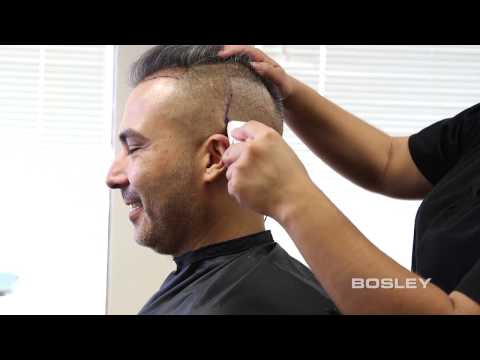 BOSLEY FUE (Follicular